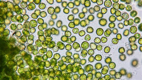  Yellow-Green Algae: A Single-Celled Powerhouse That Swims With Whip-Like Appendages!